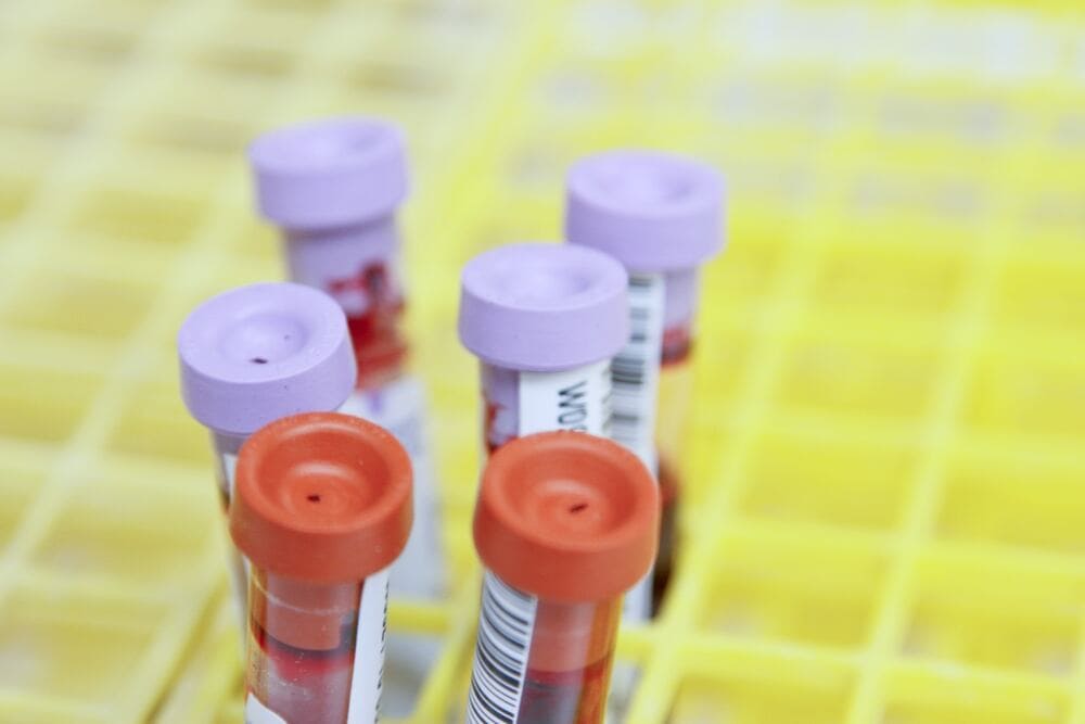 LA TIROIDE E IL SUO RUOLO NELLA FERTILITA’