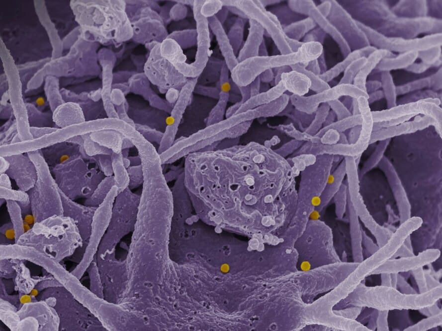 Microbiota vaginale: alleato per il ciclo mestruale